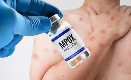 ¿Vacuna contra viruela del mono tendrá costo? México publica aviso de disponibilidad y cómo prevenir