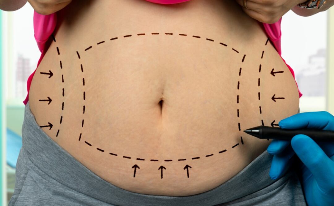 Conoce las cirugías estéticas más solicitadas en lo que va de este año. (Foto: DeDinero)