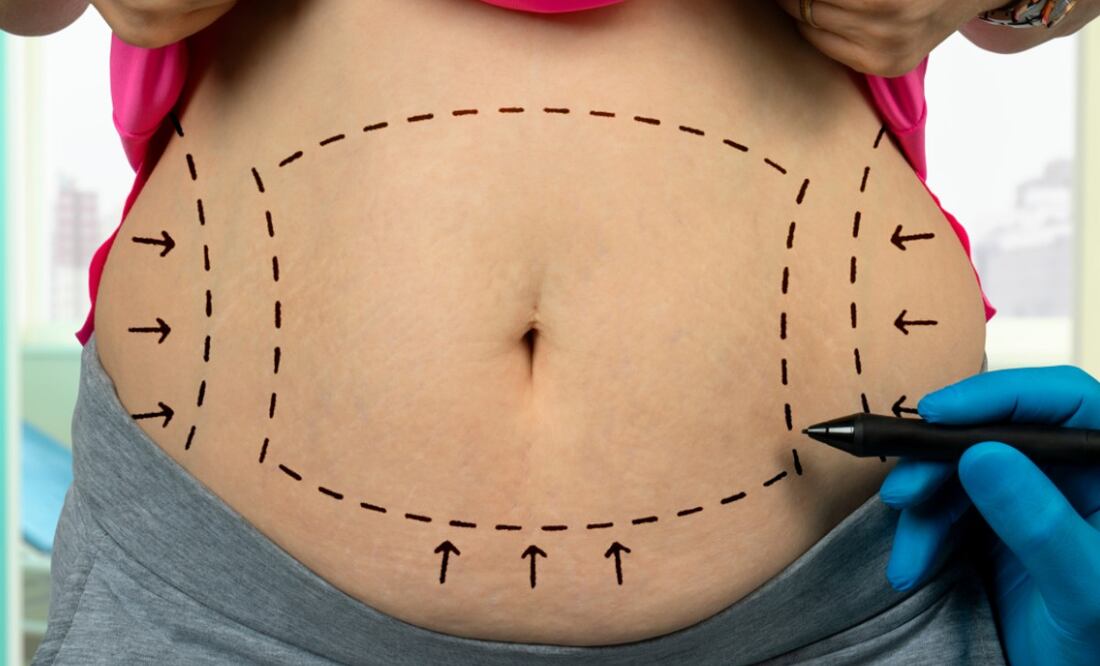 Conoce las cirugías estéticas más solicitadas en lo que va de este año. (Foto: DeDinero)