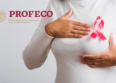Profeco y octubre rosa: qué revisar antes de pagar una promoción de mastografía o ultrasonido