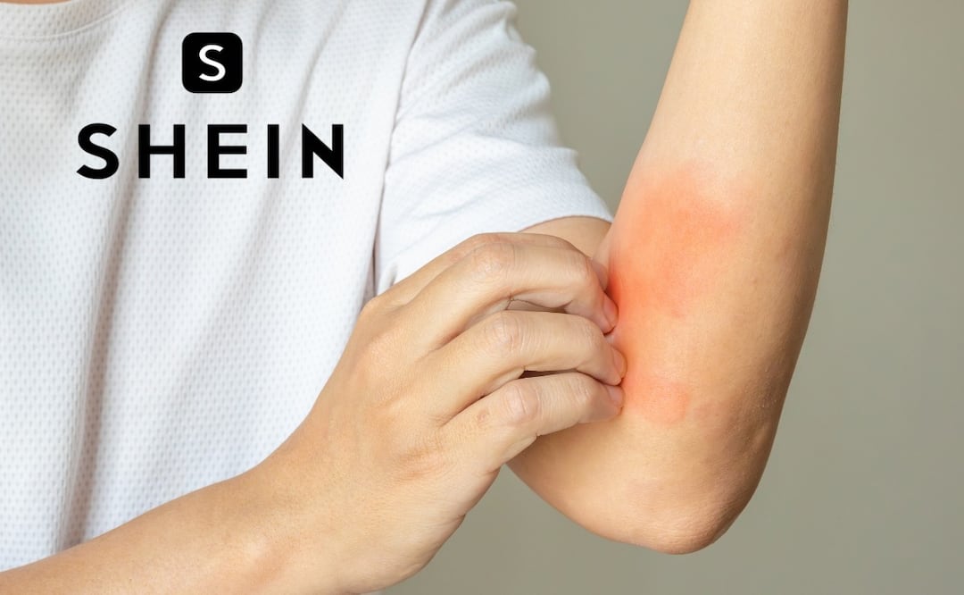¿Qué causa la dermatitis de contacto textil? Caso ropa Shein. (Foto: DeDinero)
