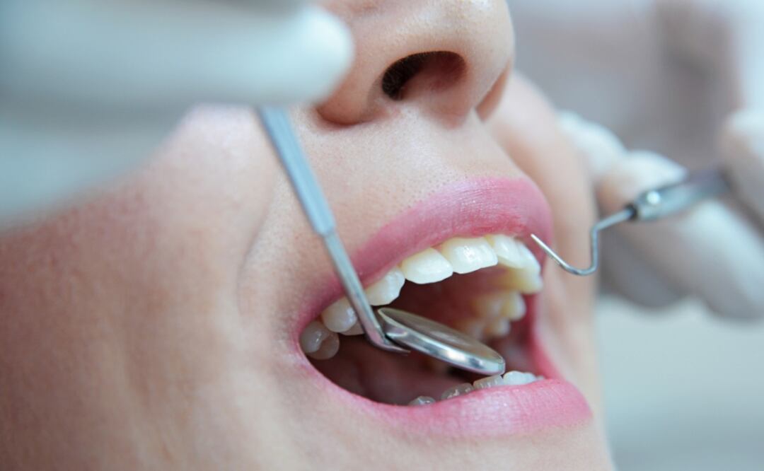 No descuides tu salud dental en clínicas de la UNAM. (Foto: DeDinero)