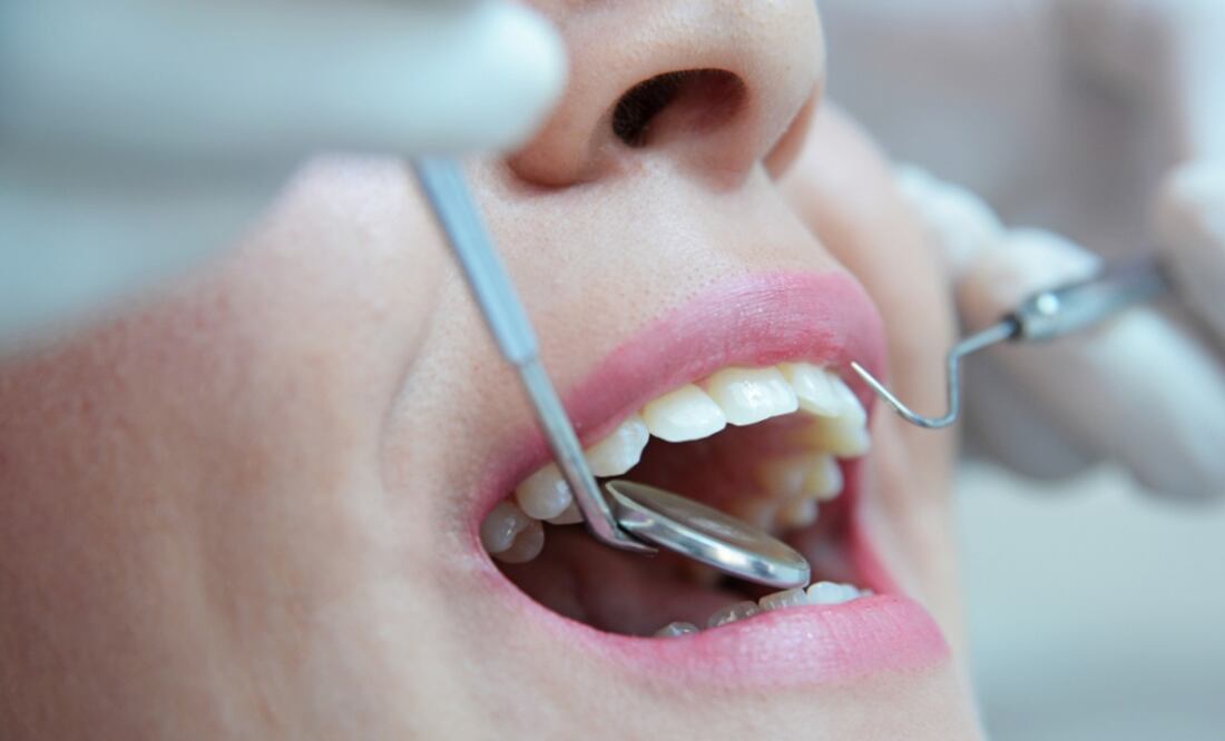 No descuides tu salud dental en clínicas de la UNAM. (Foto: DeDinero)