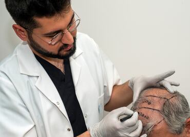 Costo de injerto de cabello en México 2024: Guía Completa de precios