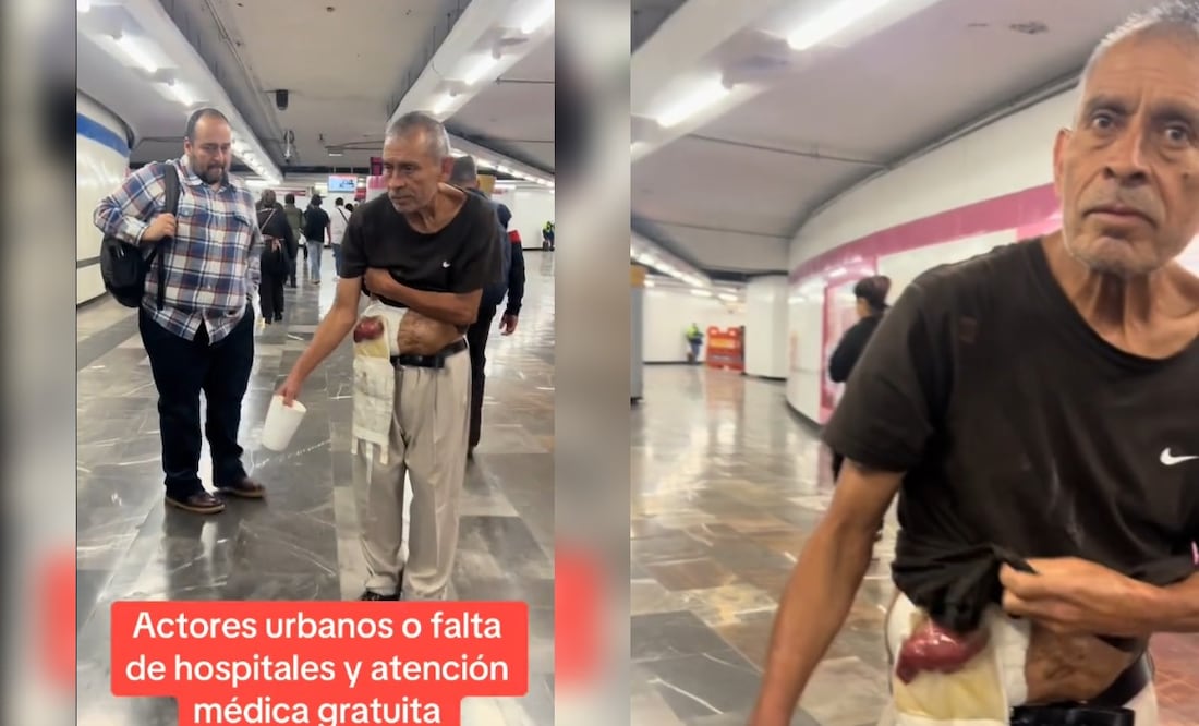 Hombre con supuesta operación pide dinero en el Metro CDMX y genera debate en redes sociales. (Foto: Captura de pantalla)