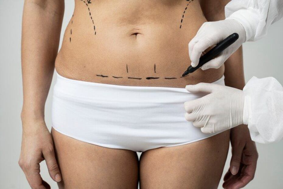 Descubrí los 5 destinos más asequibles para la liposucción con Bookimed. Fuente: Freepik.