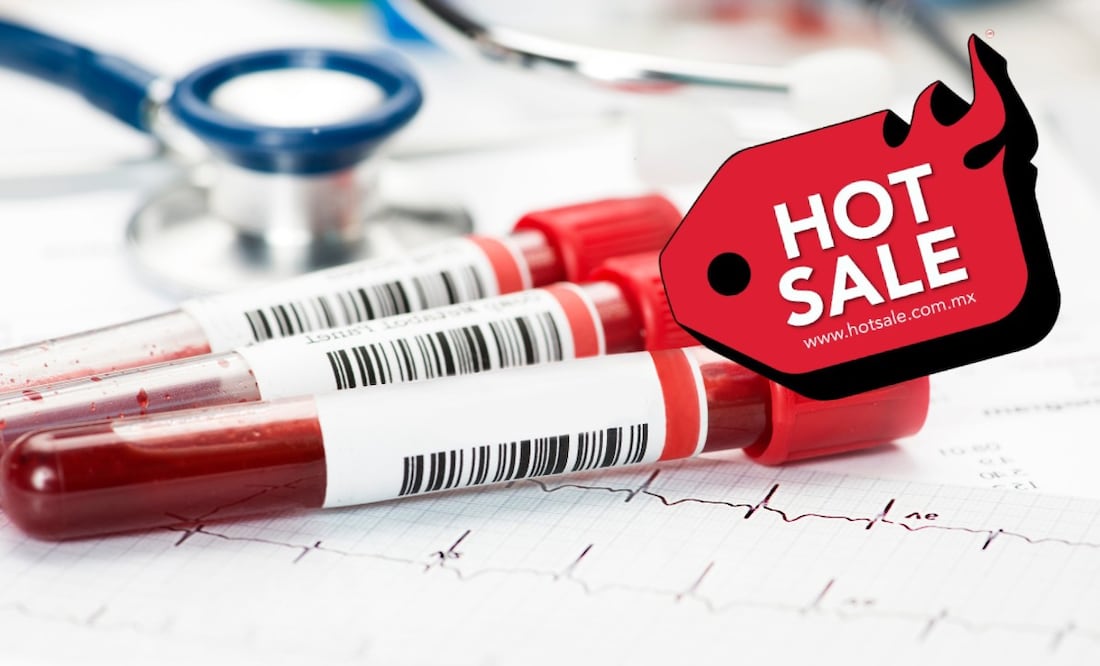 Conoce en qué estudios de laboratorio se tienen descuento por el Hot Sale. (Foto: DeDinero)