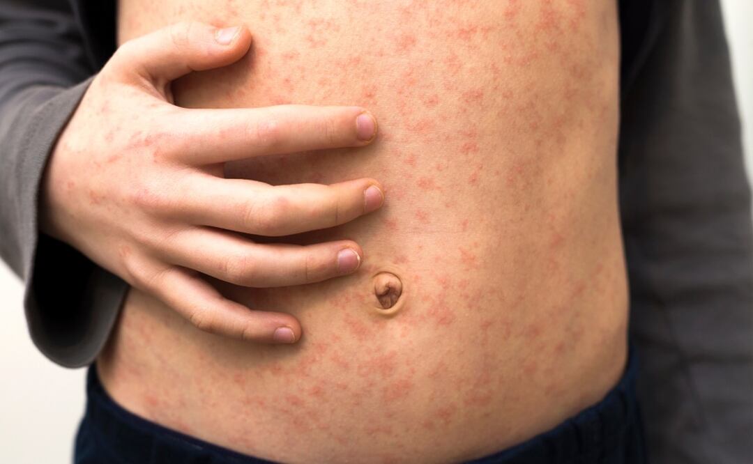 La Secretaría de Relaciones Exteriores, recomienda a los mexicanos a contar con su esquema de vacunación completa antes de viajar al extranjero. (Foto; DeDinero)