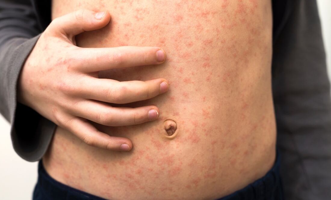 La Secretaría de Relaciones Exteriores, recomienda a los mexicanos a contar con su esquema de vacunación completa antes de viajar al extranjero. (Foto; DeDinero)