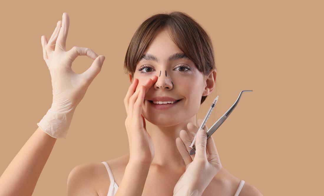 La rinoplastia es una de las cirugías más demandadas en la CDMX (Foto: Canva)