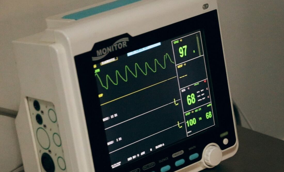 Aquí tienes algunas cosas que necesitas saber para elegir la mejor opción. (Foto: Unsplash)