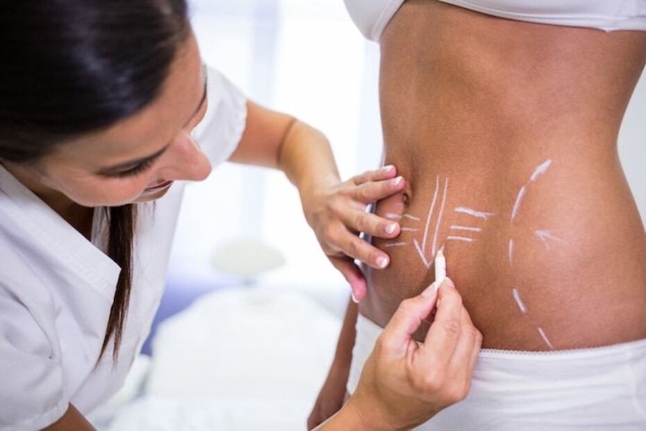 Descubrí los 5 destinos más asequibles para la liposucción con Bookimed. Fuente: Freepik.